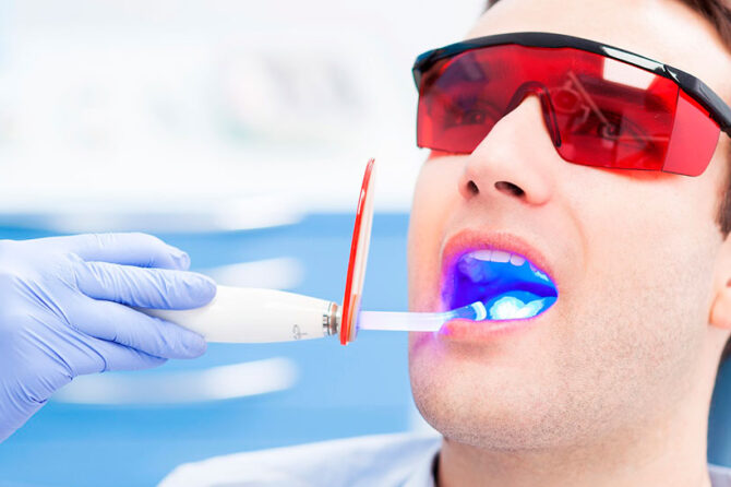 Láser, células madre y auto reparación dental